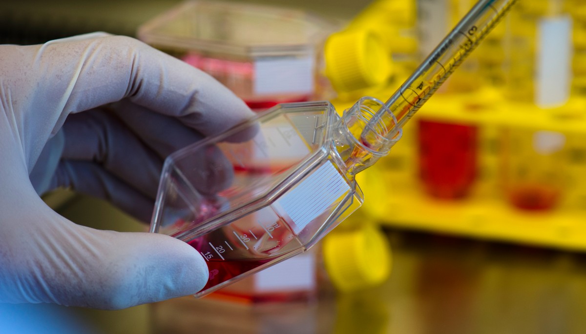 Genforschung: Japanisches Pharmaunternehmen will 50 Jobs in Käerjeng schaffen