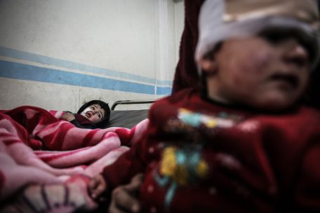 30.01.2020, Syrien, Ariha: Verwundete syrische Kinder werden behandelt, nachdem sie bei einem Luftangriff verletzt wurden, die angeblich von der syrischen Regierung in der von den Rebellen kontrollierten Provinz Idlib durchgef&uuml;hrt wurde.