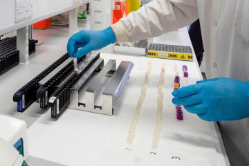 Medienbericht / Trierer Krankenhaus bestätigt erste Corona-Verdachtsfälle 