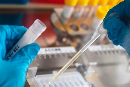 Italien-Rückkehrer / In Luxemburg gibt es eine zweite Infektion mit dem Coronavirus