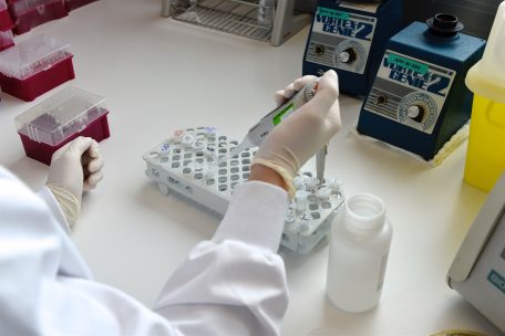 Tests am „Laboratoire national de santé“ in Düdelingen