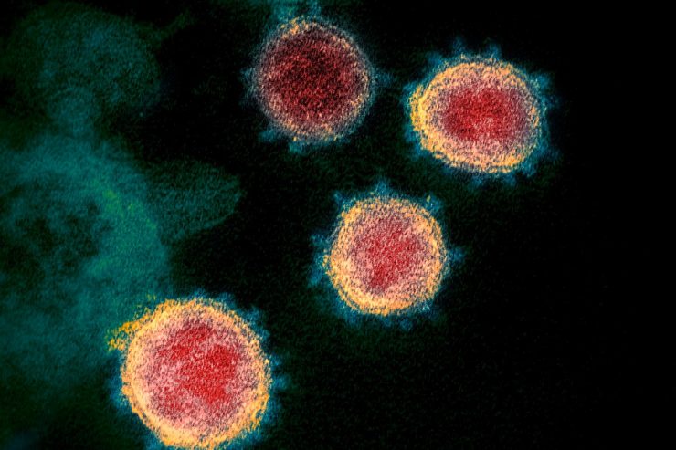 125 Nanometer Virus / So funktioniert SARS-CoV-2