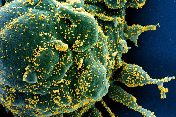 Covid-19 / Insgesamt 3.888 Menschen in Luxemburg positiv auf das Coronavirus getestet