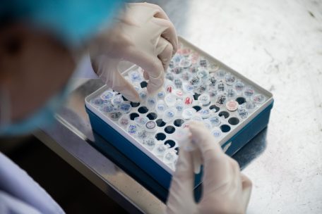 Corona-Epidemie / 3.915 Menschen in Luxemburg positiv auf Corona getestet – Zahl der Toten bleibt bei 103