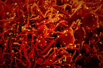 Corona-Epidemie / 4.018 Menschen in Luxemburg positiv auf Corona getestet – Zahl der Toten bleibt bei 110