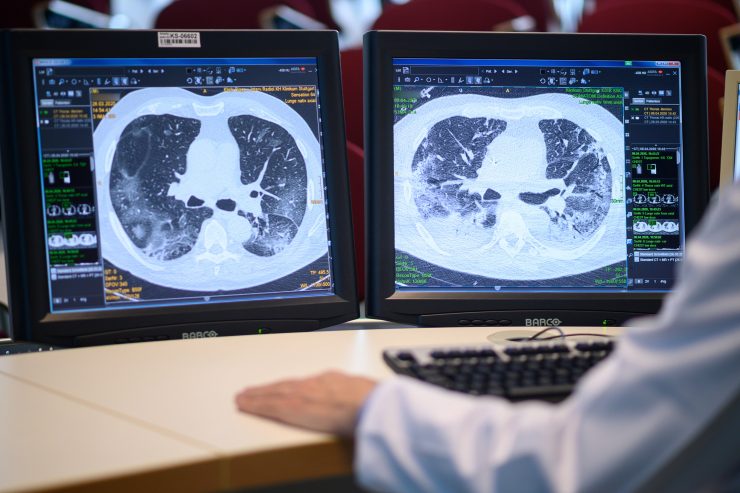 Der Weg zur Genesung / Wie es Patienten nach Covid-19 geht