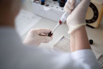 Coronavirus / Luxemburg registriert wieder etwas mehr Infektionen: 12 von 5.513 Tests positiv