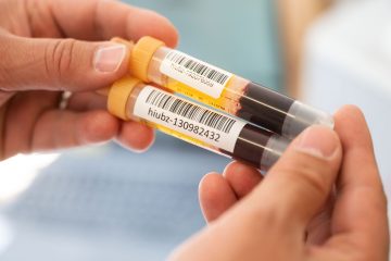 Covid-19-Studien / Infektion bedeutet wohl nicht automatisch Immunität