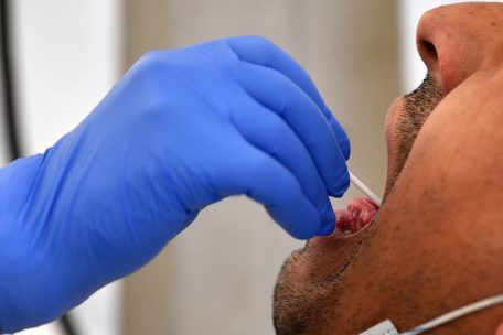 Coronavirus / 100 Neuinfektionen am Dienstag, 47 Personen im Krankenhaus