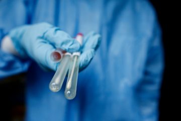 Corona-Zahlen / „Santé“ meldet am Donnerstag 67 Neuinfektionen bei 6.100 Tests