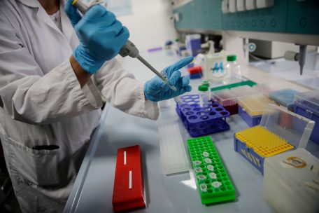 Corona-Epidemie / Santé meldet 320 Neuinfektionen am Montag – Zahl der Toten bleibt bei 160