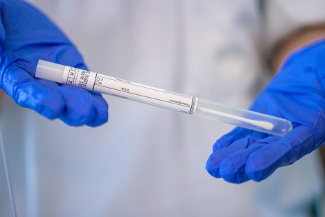 Corona-Pandemie / Luxemburg meldet am Dienstag 6 weitere Tote – und 163 neue Infektionen 