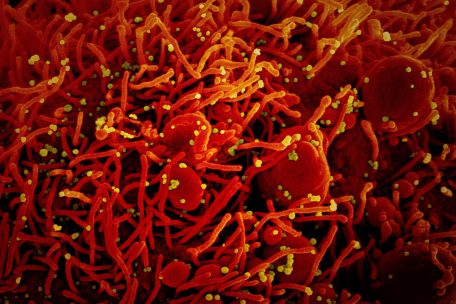 Corona-Epidemie / „Santé“ meldet 123 Neuinfektionen am Sonntag – keine weiteren Menschen gestorben