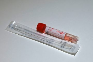 Frankreich / Neue Corona-Variante in der Bretagne gemeldet – Nachweis mit PCR-Test möglicherweise erschwert