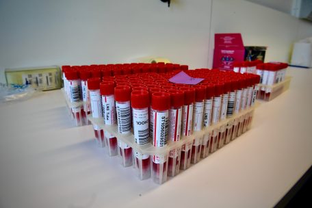 Corona-Wochenbilanz  / 25 Prozent mehr Neuinfektionen – Stagnation in den Krankenhäusern