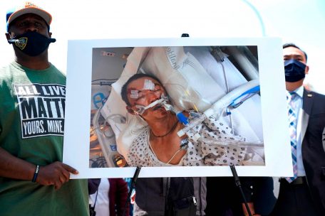 Anti-asiatischer Hass in den USA / „Alarmierende Eskalation“ durch die Corona-Pandemie