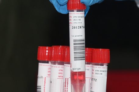 Coronavirus / In Luxemburg sind wieder 123 Neuinfektionen festgestellt worden – bei 8.725 Tests