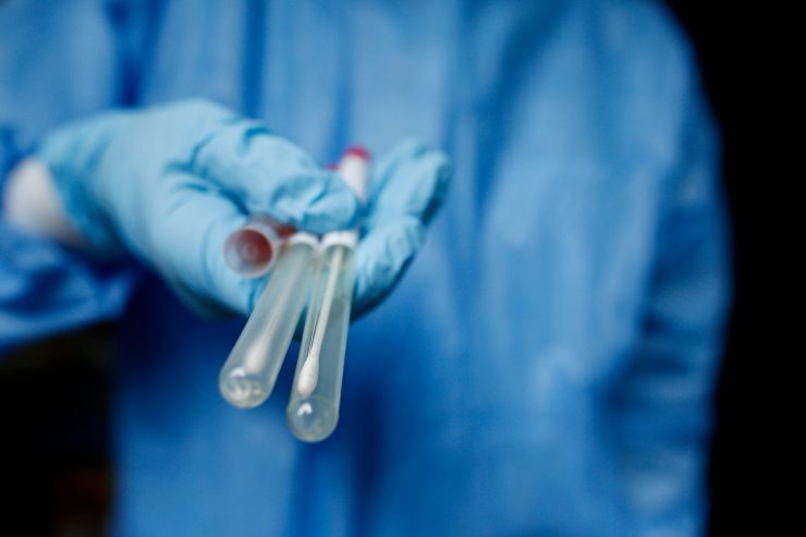 Corona-Fallzahlen / „Santé“ meldet 54 Neuinfektionen am Freitag – keine weiteren Todesfälle