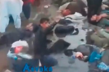 Dramatische Szenen vor dem Flughafen in Kabul: Verletzte des Anschlags rufen um Hilfe