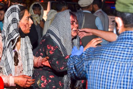 Verletzte Frauen auf dem Weg ins Krankenhaus