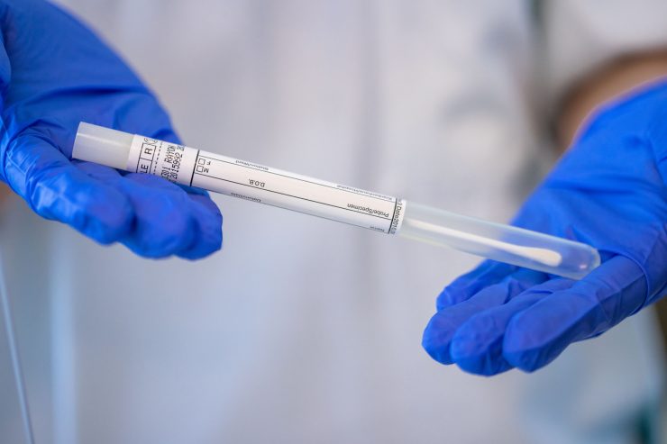 Coronavirus / „Santé“ meldet am Freitag 74 positive Tests von 2.103 – kein neuer Todesfall