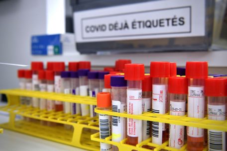 Luxemburg / „Santé“ meldet am Donnerstag 1.994 von 6.222 Tests positiv – mehr als 2.000 Booster-Impfungen