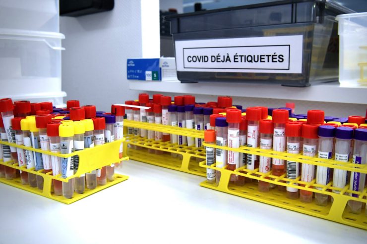 Corona-Pandemie / „Santé“ meldet am Montag 1.437 von 6.925 Tests positiv – sieben weitere Menschen sterben