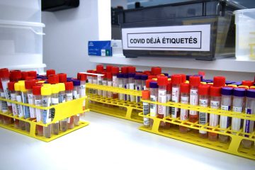 Corona-Fallzahlen / Santé meldet am Mittwoch von 2.810 Tests 822 positive – ein weiterer Mensch stirbt