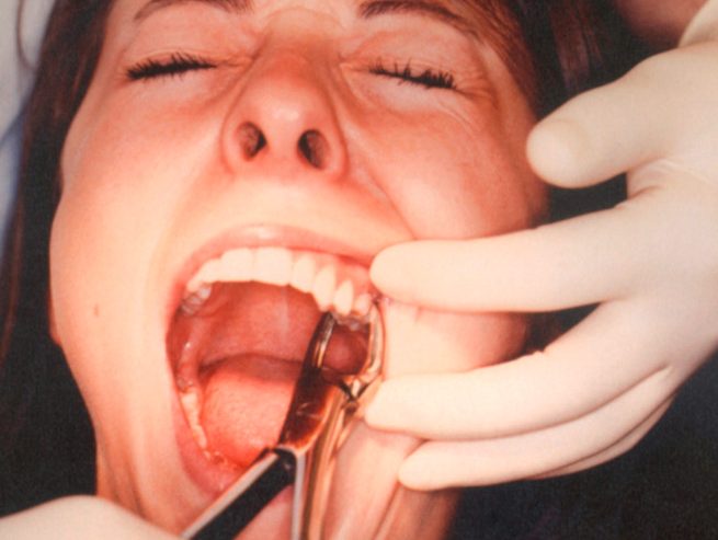 Vor Gericht / Horror-Zahnarzt zog massenhaft gesunde Zähne im Armenviertel von Marseille