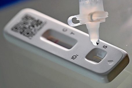 Paris / Forscher heilen Mann nach 411 Tagen andauernder Corona-Infektion