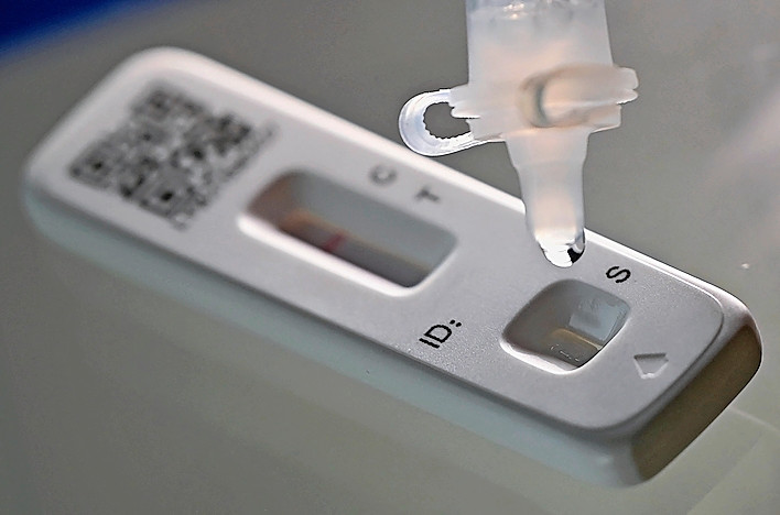 Paris / Forscher heilen Mann nach 411 Tagen andauernder Corona-Infektion