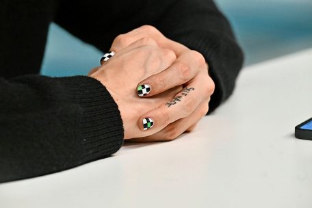 Der 27-J&auml;hrige tr&auml;gt ein besonderes Markenzeichen