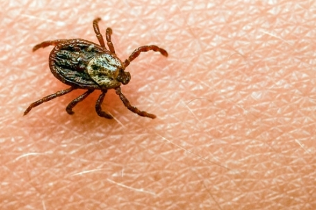 Vorsicht, aber keine Panik / Faktencheck: Wie gefährlich sind Zecken und wie kann man sich schützen?