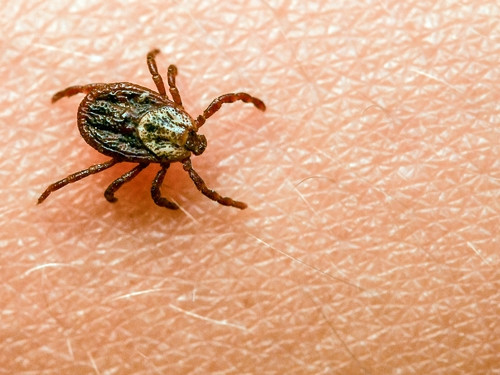 Vorsicht, aber keine Panik / Faktencheck: Wie gefährlich sind Zecken und wie kann man sich schützen?