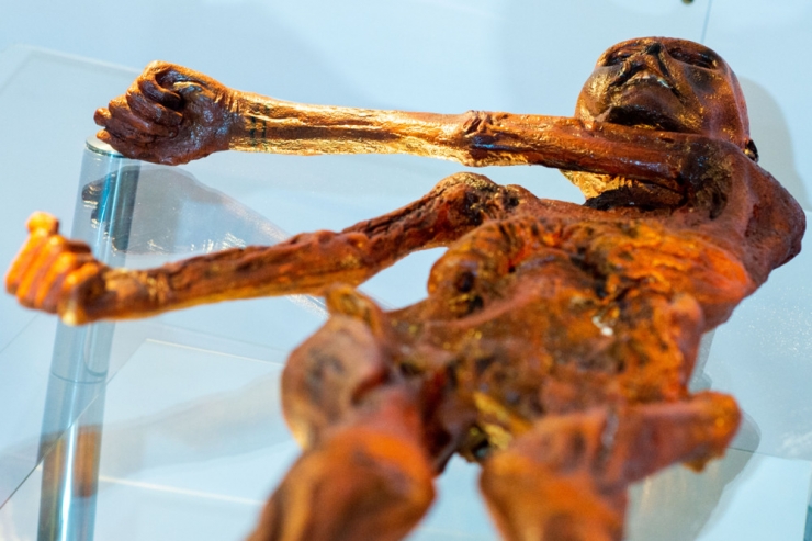 Forschung / Ötzi hatte fortgeschrittene Glatze und dunklere Haut als angenommen