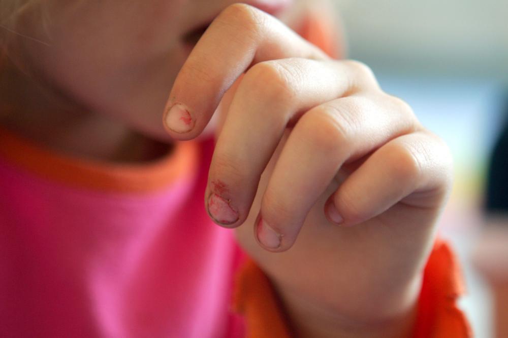 Daumenlutschen härtet offenbar gegen Allergien ab